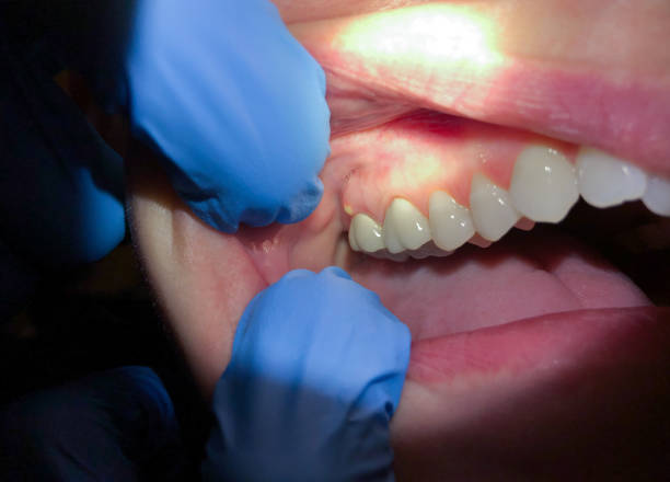 Best Emergency Gum Pain Relief  in Nora Springs, IA